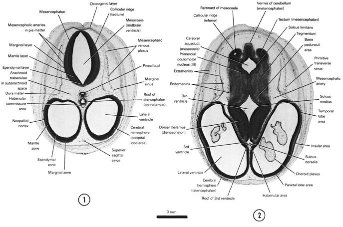 Open PDF version of FIG 8-3, A section through the cerebral hemispheres (occipital lobe area), the roof of the diencephalon and the tectum of the mesencephalon. A section through the cerebral hemisphere (parietal and temporal lobe areas), dorsal thalamus and basis pedunculi area, tegmentum and tectum of the mesencephalon.