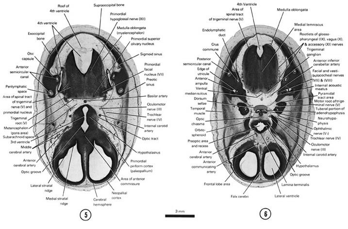 Open PDF version of FIG 8-5, A section through the cerebral hemispheres, hypothalamus, metencephalon and medulla oblongata. A section through the cerebral hemispheres (frontal lobe area), hypothalamus and medulla oblongata.