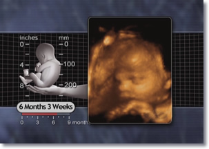 7 week 3d ultrasound