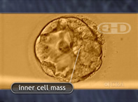 See Labels [Blastocyst with Inner Cell Mass]