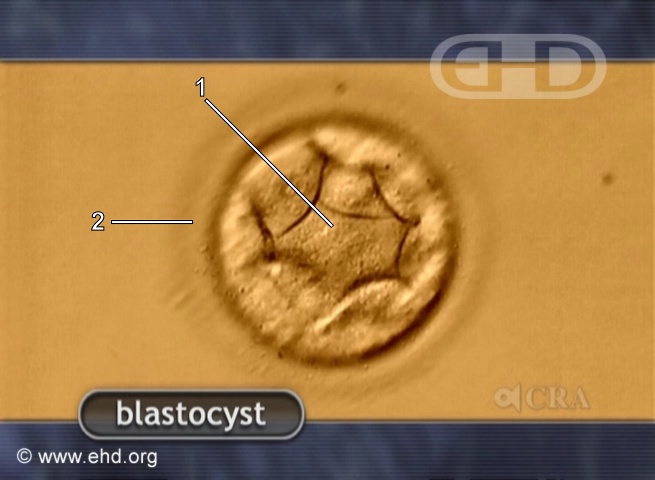 Blastocyst [Click for next image]