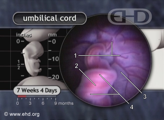 Close-up of Umbilical Cord [Click for next image]