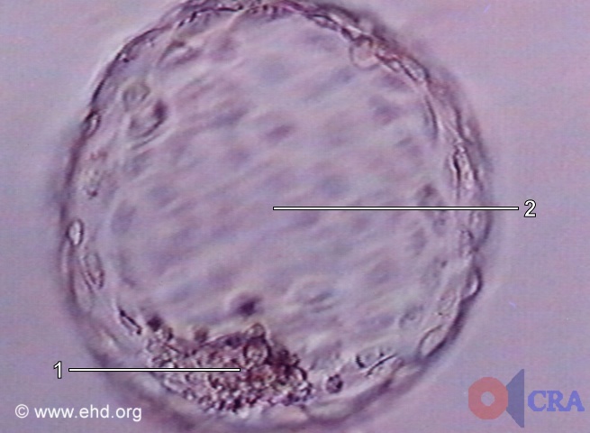 Free Blastocyst  (without zona) [Click for next image]