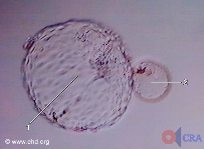 Hatched Blastocyst [Click for next image]