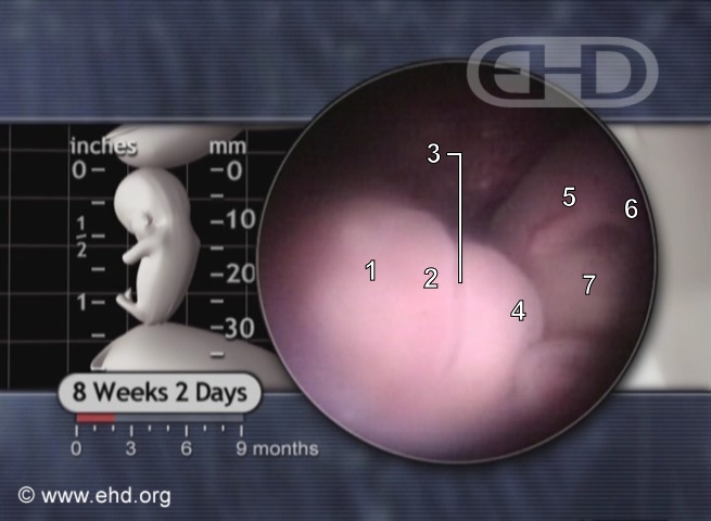 Nose and Mouth, 8 Weeks Pregnant [Click for next image]