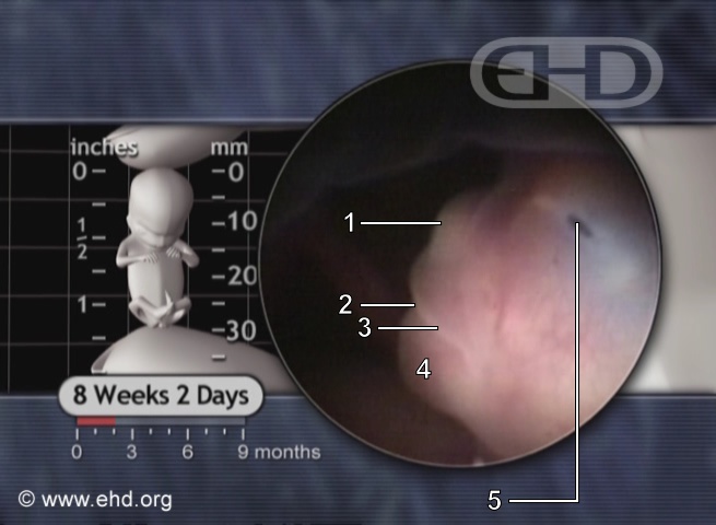 Nose, Eight Weeks Pregnant [Click for next image]