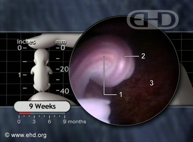 The 9-Week Umbilical Cord [Click for next image]