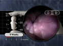 The 9-Week Fetus