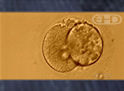 Two-Cell Human Embryo
