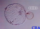 Hatched Blastocyst