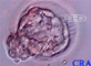 Hatching Blastocyst