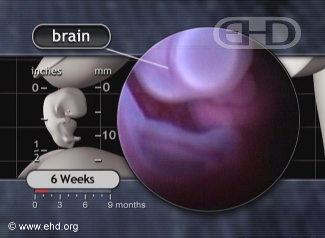 Brain and Umbilical Cord [Click for next image]