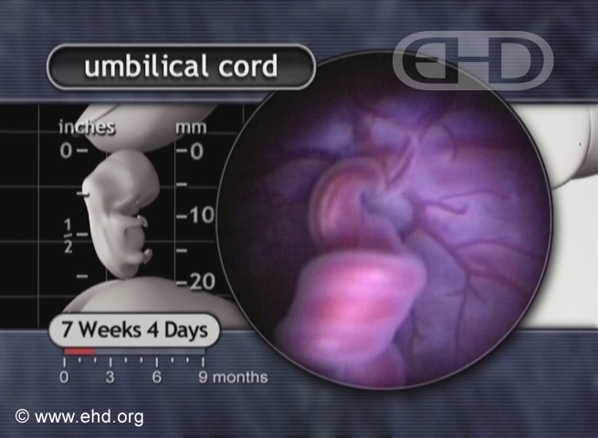 Close-up of Umbilical Cord