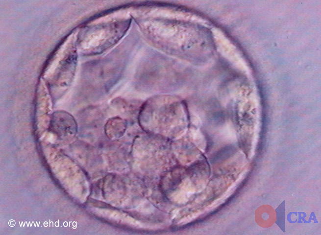 Early Blastocyst [Click for next image]