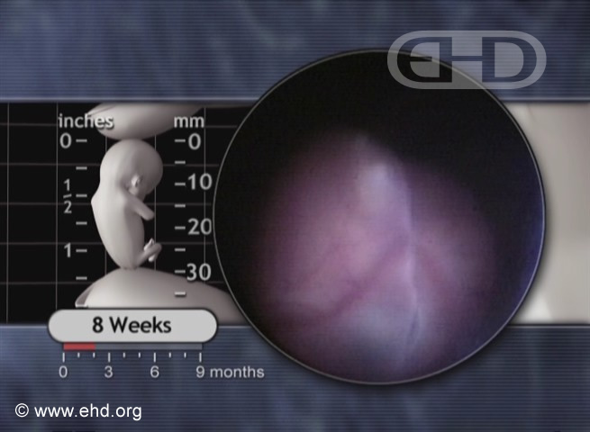 Eye & Nose, Eight-Week Embryo [Click for next image]