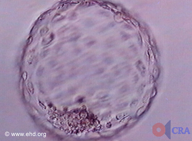 Free Blastocyst  (without zona)