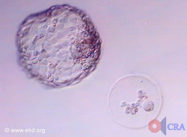 Hatched Blastocyst