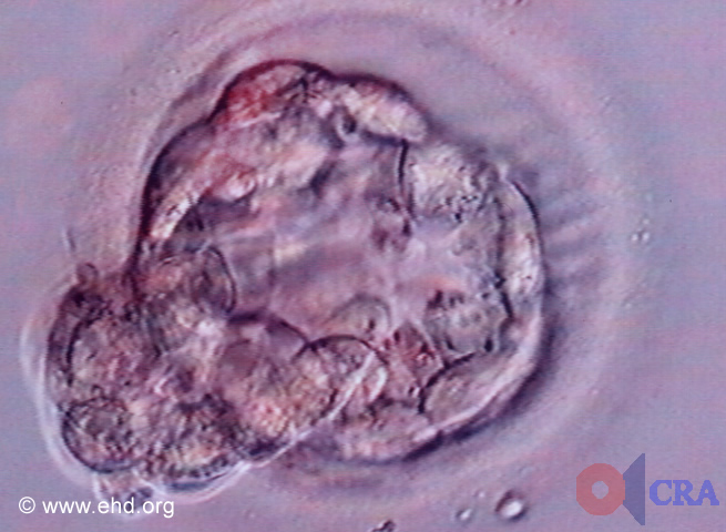 Hatching Blastocyst