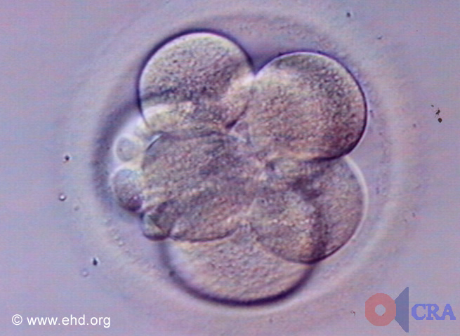 Seven-Cell Embryo [Click for next image]